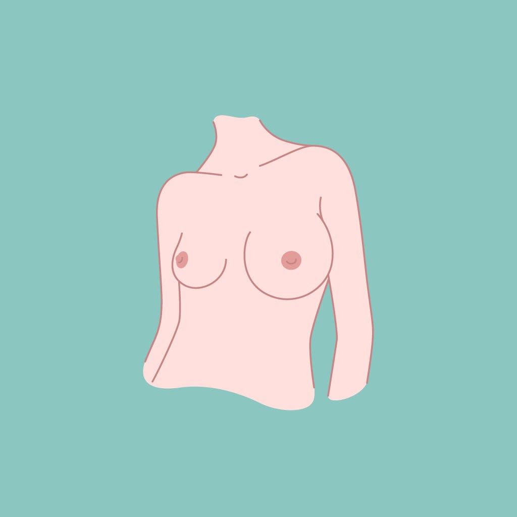 Asymmetrical Breast