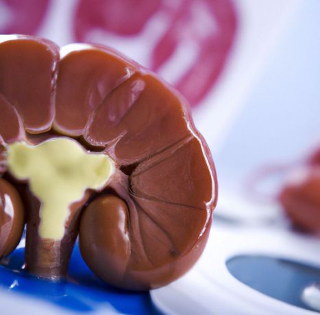 Anatomical model of a human kidney illustrating an article about the causes, symptoms, and treatment of pyelonephritis